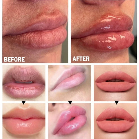 Non-Invasive Magic Lip Plumping Serum
